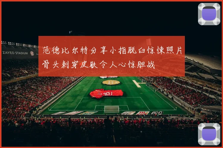 范德比尔特分享小指脱臼惊悚照片骨头刺穿皮肤令人心惊胆战